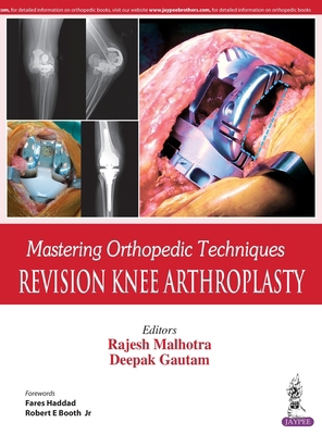 Mastering Orthopedic Techniques: Revision Knee ... 9352705831 Book Cover