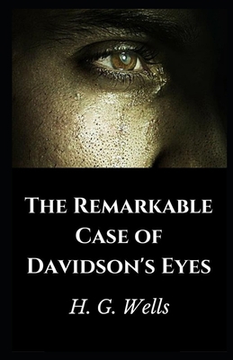 Paperback The Remarkable Case of Davidson's Eyes Illustrated Book
