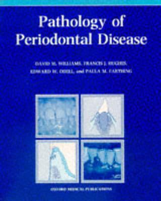 Pathology of Periodontal Disease 0192621203 Book Cover