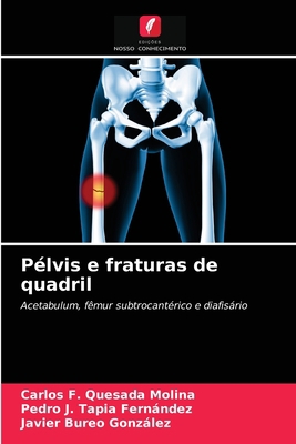 Pélvis e fraturas de quadril [Portuguese] 6203641138 Book Cover