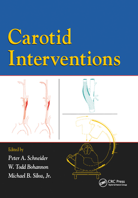 Carotid Interventions 0367454335 Book Cover
