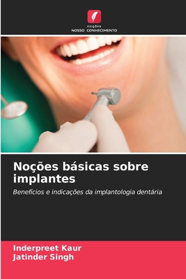 Noções básicas sobre implantes [Portuguese] 6202209380 Book Cover