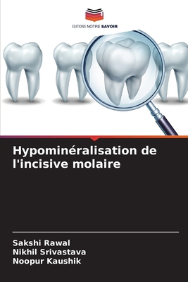 Hypominéralisation de l'incisive molaire [French] 6204153692 Book Cover