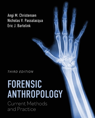 Forensic Anthropology: Current Methods and Prac... B0D1GNKYSN Book Cover