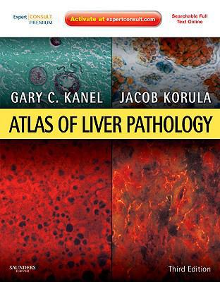 Atlas of Liver Pathology: Expert Consult - Onli... 1437707653 Book Cover