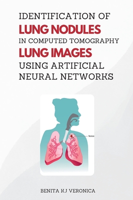 Identification of Lung Nodules in Computed Tomo... 7692280967 Book Cover