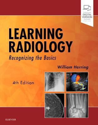 Learning Radiology: Recognizing the Basics 0323567290 Book Cover