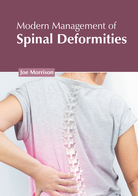 Modern Management of Spinal Deformities 163989361X Book Cover