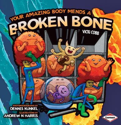 Your Amazing Body Mends a Broken Bone (Your Ama... 0761344233 Book Cover