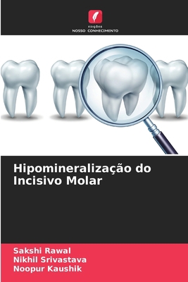 Hipomineralização do Incisivo Molar [Portuguese] 6204153668 Book Cover