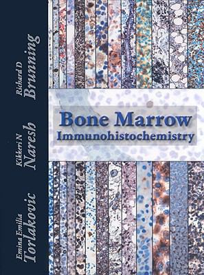 Bone Marrow IHC 0891895728 Book Cover