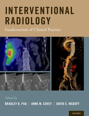 Interventional Radiology: Fundamentals of Clini... 019027624X Book Cover
