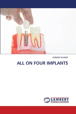 All on Four Implants 6208225302 Book Cover