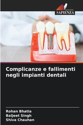 Complicanze e fallimenti negli impianti dentali [Italian] 6208232767 Book Cover