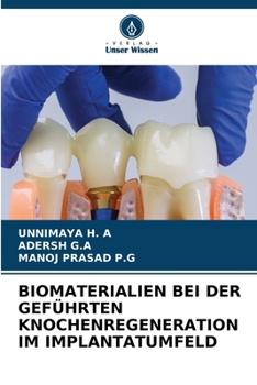 Biomaterialien Bei Der Geführten Knochenregeneration Im Implantatumfeld (German Edition)