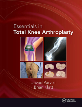 Hardcover Essentials in Total Knee Arthroplasty Book
