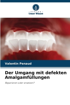 Paperback Der Umgang mit defekten Amalgamfüllungen [German] Book