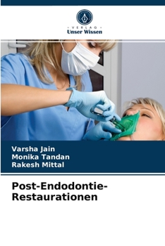 Paperback Post-Endodontie-Restaurationen [German] Book