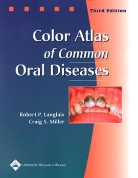 Paperback Color Atlas of Common Oral Diseases Book