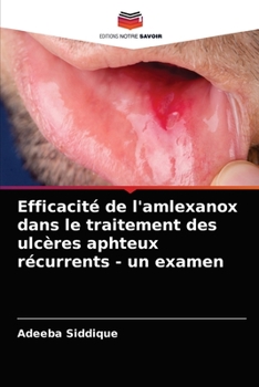 Paperback Efficacité de l'amlexanox dans le traitement des ulcères aphteux récurrents - un examen [French] Book
