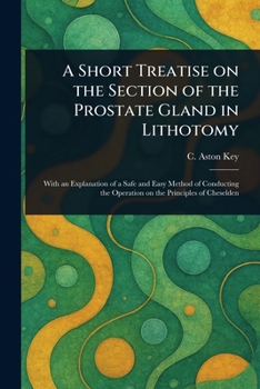 Paperback A Short Treatise on the Section of the Prostate Gland in Lithotomy Book