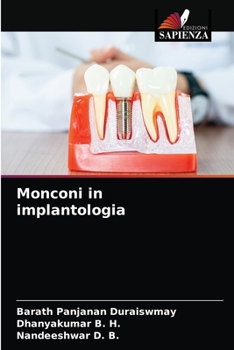 Paperback Monconi in implantologia [Italian] Book