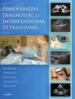 Hardcover Perioperative Diagnostic and Interventional Ultrasound with DVD [With DVD] Book
