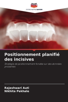 Positionnement planifié des incisives (French Edition)