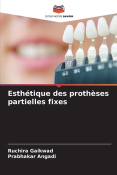 Esthétique des prothèses partielles fixes (French Edition)