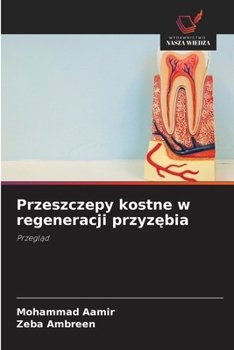Paperback Przeszczepy kostne w regeneracji przyz&#281;bia [Polish] Book