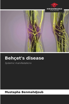 Paperback Behçet's disease Book