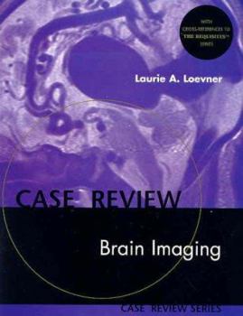 Hardcover Brain Imaging: Case Review Series Book