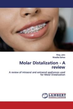 Paperback Molar Distalization - A review Book