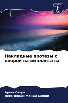Paperback Накладные протезы с опор [Russian] Book