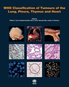 Paperback Who Classification of Tumours of the Lung, Pleura, Thymus and Heart [Op] Book