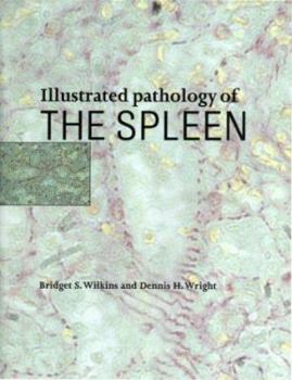 Hardcover Illustrated Pathology of the Spleen Book