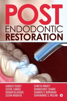Paperback Post Endodontic Restoration Book