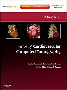 Hardcover Atlas of Cardiovascular Computed Tomography: Expert Consult - Online and Print: Imaging Companion to Braunwald's Heart Disease (Imaging Techniques to Braunwald's Heart Disease) Book