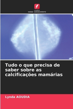 Tudo o que precisa de saber sobre as calcificações mamárias (Portuguese Edition)