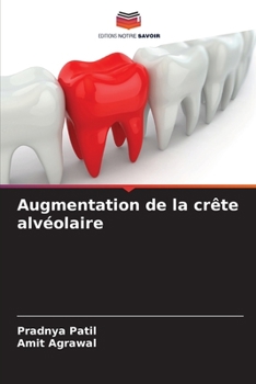 Paperback Augmentation de la crête alvéolaire [French] Book