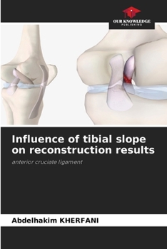Paperback Influence of tibial slope on reconstruction results Book