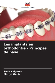 Paperback Les implants en orthodontie - Principes de base [French] Book