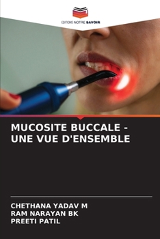 Mucosite Buccale - Une Vue d'Ensemble (French Edition)