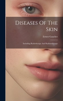 Hardcover Diseases Of The Skin: Including Radiotherapy And Radiumtherapy Book