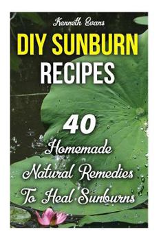 Paperback DIY Sunburn Recipes: 40 Homemade Natural Remedies To Heal Sunburns Book