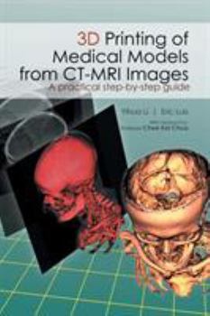 Paperback 3D Printing of Medical Models from CT-MRI Images: A Practical step-by-step guide Book