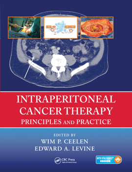 Paperback Intraperitoneal Cancer Therapy: Principles and Practice Book