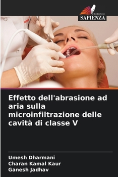 Effetto dell'abrasione ad aria sulla microinfiltrazione delle cavità di classe V (Italian Edition)
