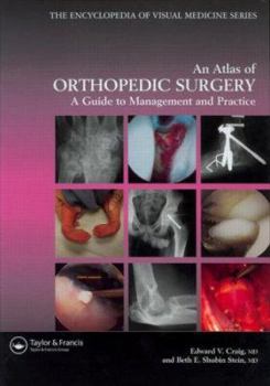 Hardcover Atlas of Orthopedic Surgery Book