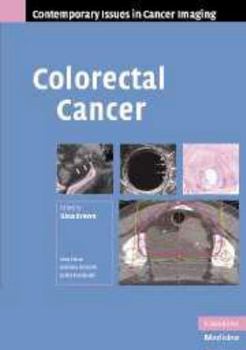 Colorectal Cancer - Book  of the Contemporary Issues in Cancer Imaging